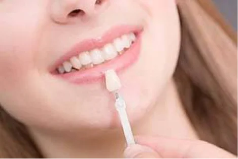 Visit Our Cosmetic Dentist Office For These Procedures