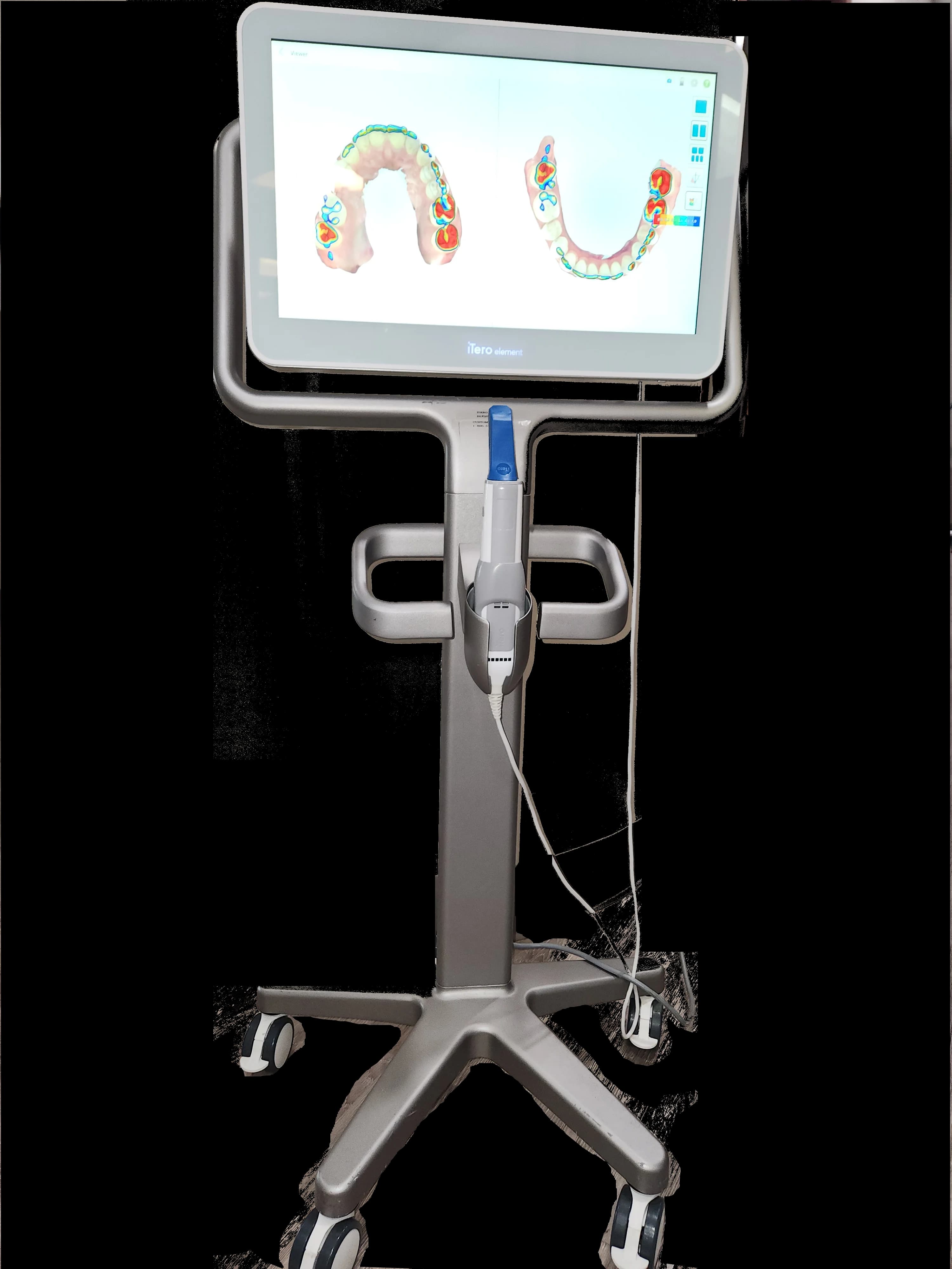 iTero digital scanner