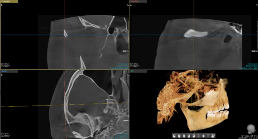 CBCT scanner in operatory